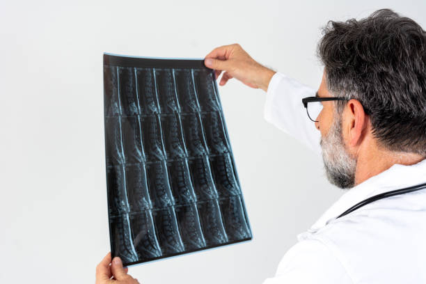 istock Doctor looking at MRI of spinal cord. 2175918186