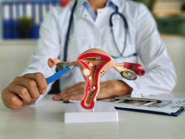 istock Gynecologist and scalpel with female reproductive system 2176053073