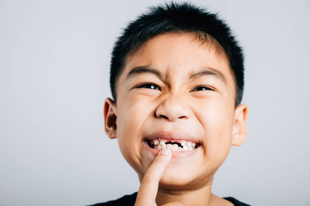 Adorable boy six smiling wide points to first permanent molar gap. cheerful portrait showcasing child dental growth exfoliation and happy phase of losing baby teeth. teeth new gap dentist problems lindo niño en edad preescolar ampliamente sonriente muestra espacio con molar en crecimiento. retrato alegre de un niño de seis años que pierde los dientes de leche, momento significativo en el crecimiento y el cuidado dental. dientes nuevos problemas d