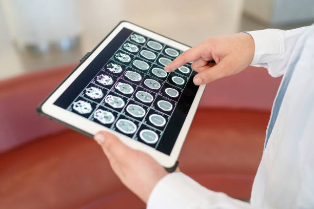 istock Close-up of doctor analyzing brain mri scan on digital tablet 2176227992