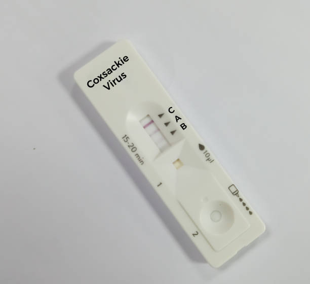 istock Rapid test device for Hand foot and mouth disease (HFMD) test. It is a highly contagious infection. It's caused by viruses from the Enterovirus genus, most commonly the coxsackievirus. 2176300796