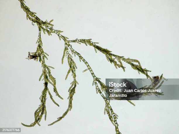 Green Under Microscope Marine Green Algae Under The Microscope Optical Microscope X100 ...