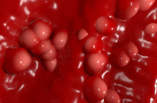 Ulcerative colitis (UC) - closeup view 3d illustration stock photo