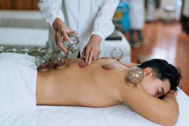 pexels-photo-8312830-8312830 Detailed image of cupping therapy on a person's back, showcasing alternative medicine practice.