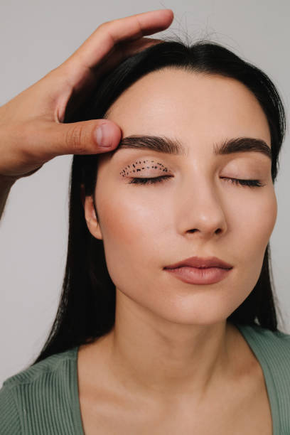 istock Blepharoplasty mark up. Lifting eye lids with precise planning. Doctor is drawing up plan for upper eye lid surgery with medical marker. 2177127421