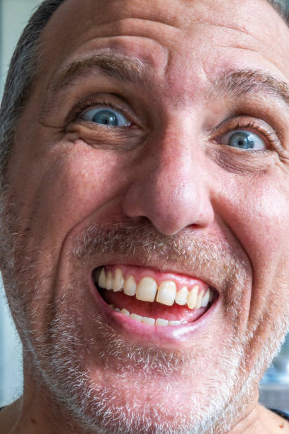 Close up of funny and weird, mimic and face expression of a man with blue eyes and stubble.