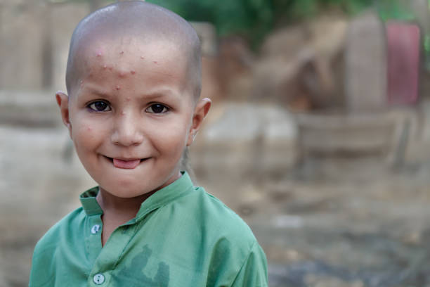 Innocent Boy with Unique Skin Condition in a Rural Setting