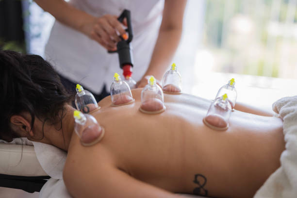 istock Therapist performing blood suction with cups 2177605047