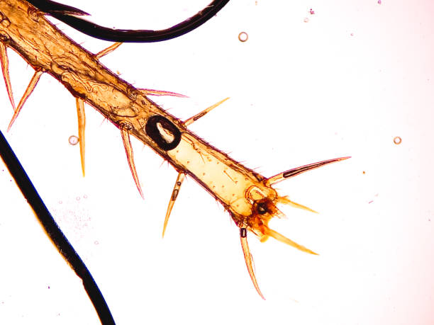 istock Microscopic image of the cockroach leg. 2177618545