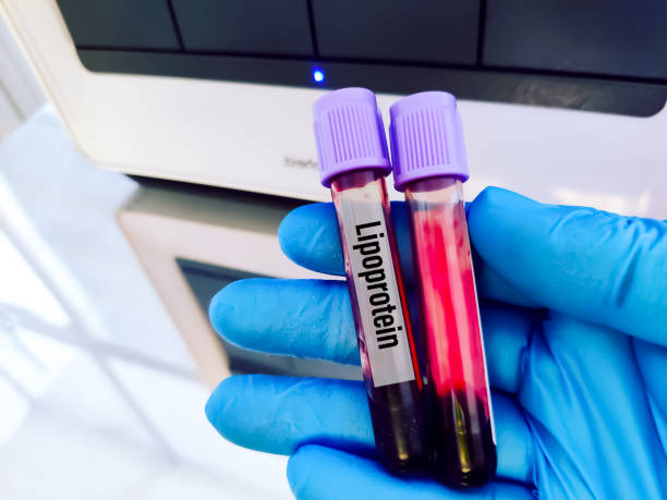 istock Blood sample for lipoprotein (a) blood test. 2177619050