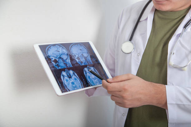 istock Doctor analyzing X-ray brain image in digital tablet, close up 2177642556