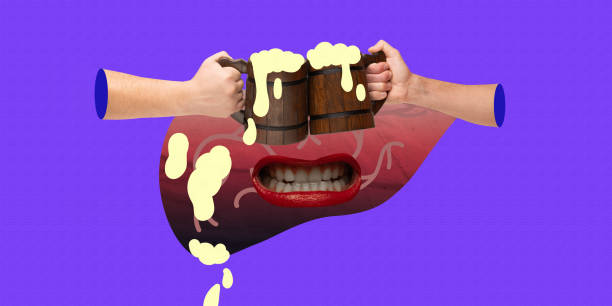 istock Digestive system overpowered by beer consumption, showing strain on body from excessive alcohol intake. Need for liver care and moderation. Contemporary art collage. 2177721434
