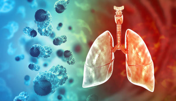 istock Virus attacking the human lungs. Lung disease. Viral infection. 3d illustration 2177724346