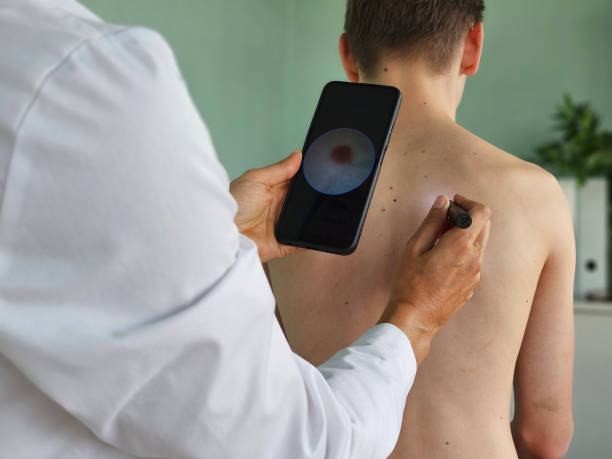 istock Method of dermatoscopy of skin formations and moles digital dermatoscope 2178382559