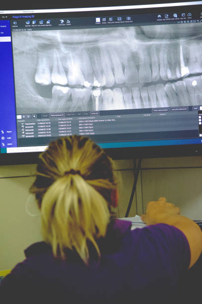 istock Female dentist observes dental panoramic x-ray radiography on screen 2178410118