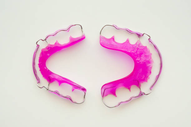 Dental bridge on plaster dental arch, dentistry prosthesis, teeth implant over molar and premolar