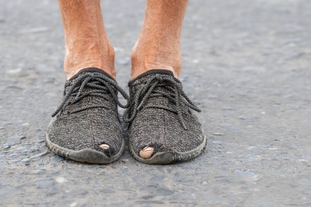 Men's moccasins with a hole.Worn-out torn shoes.