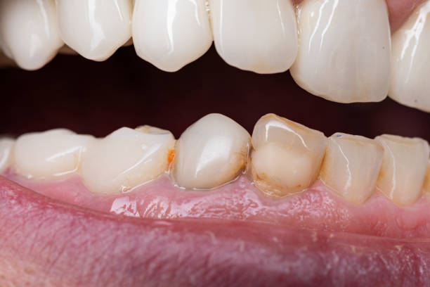istock Caucasian man open mouth with teeth and gums, macro close up shot 2178497787