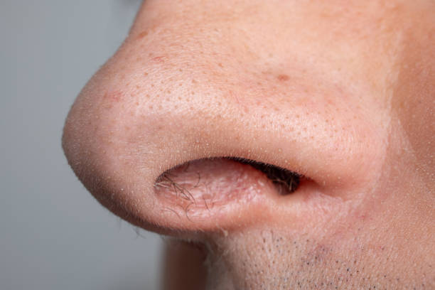 istock Caucasian man open nose, looking up, macro close up shot, unrecognizable 2178497855