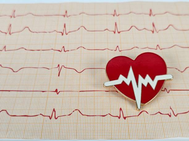 istock Heartbeat line displayed with a heart-shaped accessory resting on an ECG graph background 2178814521