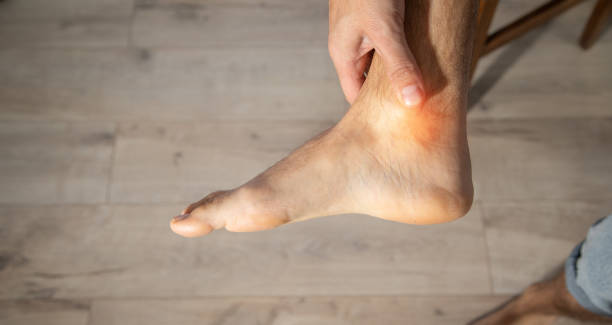 istock Caucasian man with pain in foot. 2179669701