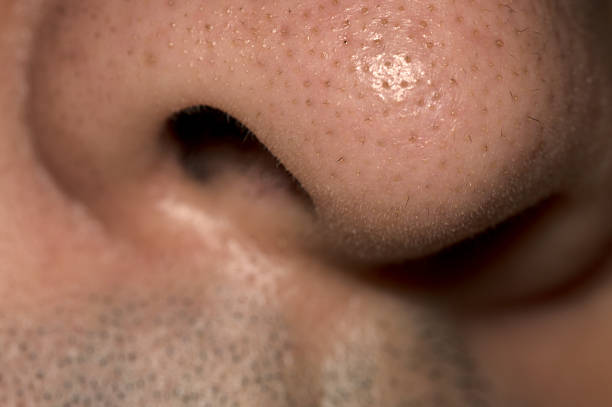istock close up of blackheads on nose 2179805384