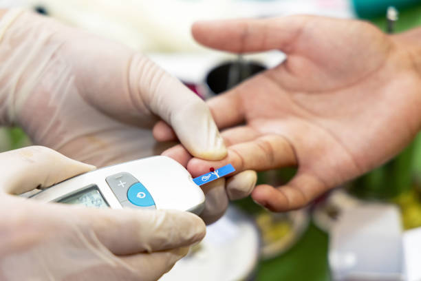 istock Nurse collecting blood sample from patient's finger with lancet. 2179905797