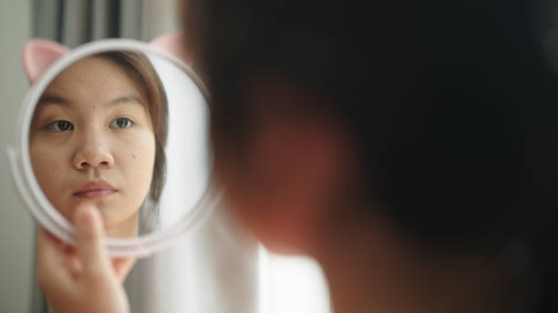 istock Teenager with acne. 2179929533