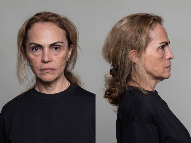serious mature adult woman front and profile mugshots - mugshot stockfoto's en -beelden