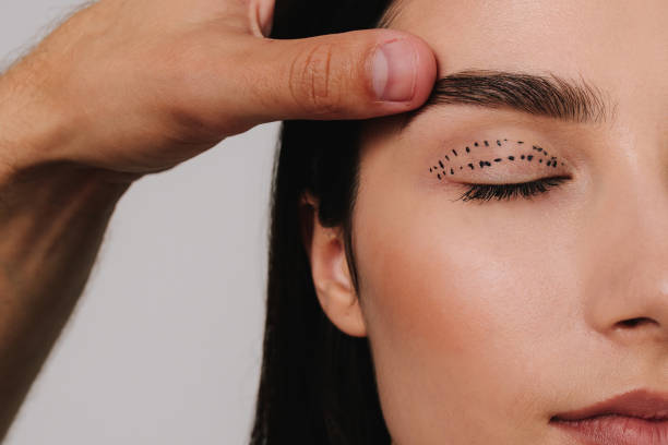istock Blepharoplasty mark up. Lifting eye lids with precise planning. Doctor is drawing up plan for upper eye lid surgery with medical marker. 2180100417