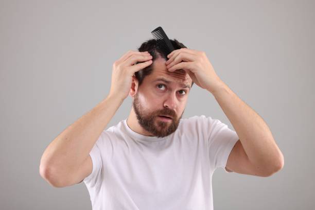 istock Dandruff problem. Man with comb examining his hair and scalp on light gray background 2180140279
