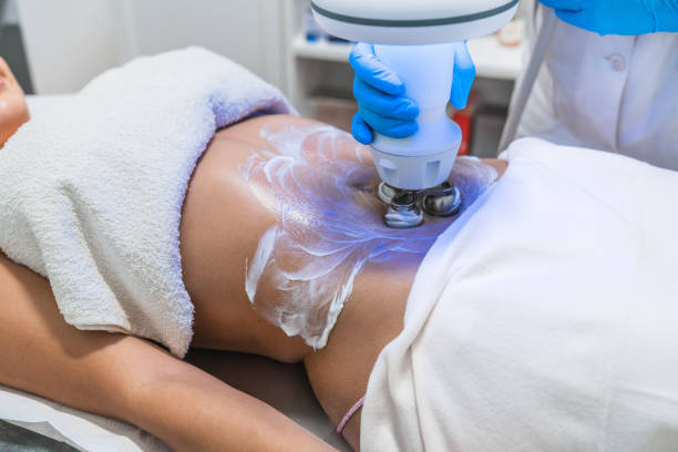 istock Beautician applying gel for hardware body shaping procedure 2180428917