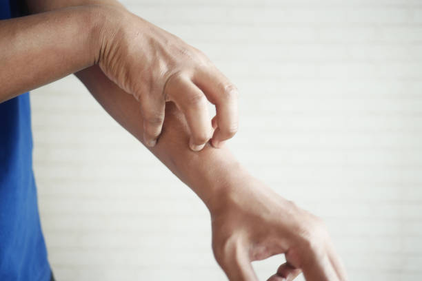 istock man suffering from itching skin, close up. 2181277928