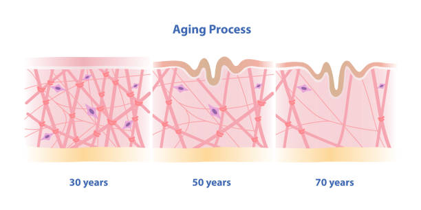 Aging skin Clipart Vector PNG , SVG, EPS, PSD, AI
