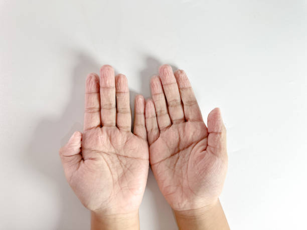 istock A pair of small, wrinkled hands are shown facing upward 2181835108