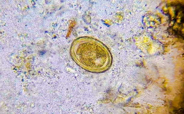 istock Egg of Ascaris lumbricoides roundworm in stool analyze by microscope. 2181877025