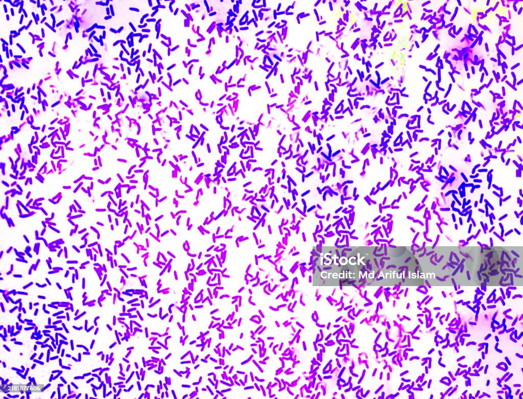 Lactococcus Spp Lactobacillus Spp Bacteria Micrograph Stock Photo - Download Image Now ...