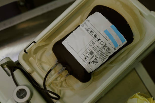 Close-up image showing filled blood donation bag with attached tubes labeled with medical information sitting in a container during hospital procedure