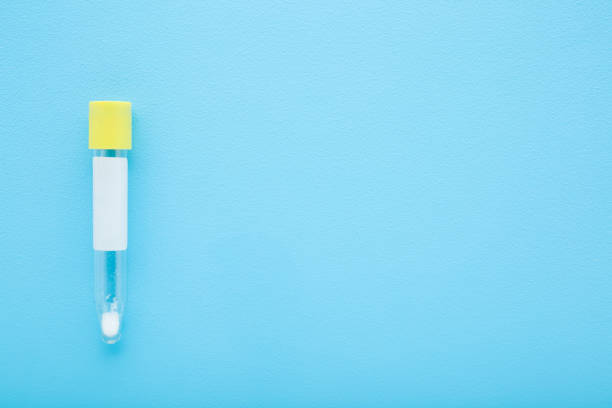istock Empty transparent plastic tube for urine or other analysis test on light blue table background. Pastel color. Healthcare concept. Closeup. Empty place for text. Top down view. 2182226905