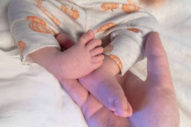 Infant with right club foot