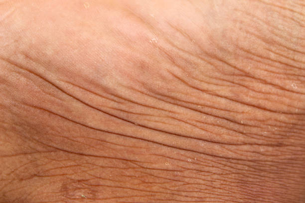 istock Wrinkled skin texture on men's legs 2182945496