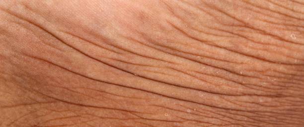 istock Wrinkled skin texture on men's legs 2182945502