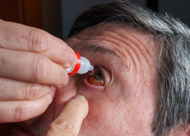 istock Man applying post-surgery eye drops for retinal detachment recovery 2183038597