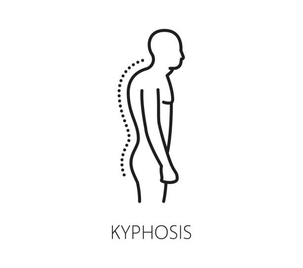 Kyphosis icon, chiropractic medicine spine posture Kyphosis line icon for chiropractic medicine and spine curvature disease, vector pictogram. Chiropractic and chiropractor medical symbol of kyphosis, body spine pathology and abnormal back posture kyphosis stock illustrations
