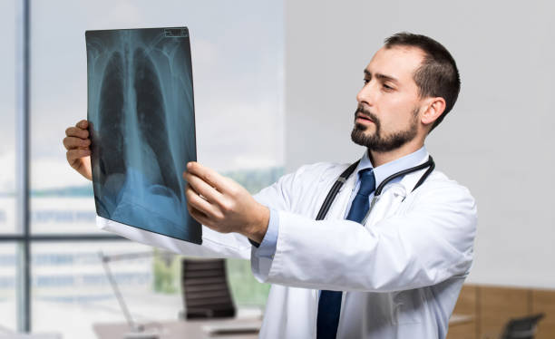 istock Doctor examining a chest x-ray in a medical office 2183123197