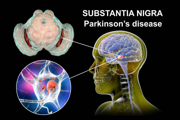 istock Substantia nigra in Parkinson's disease, illustration 2183246637