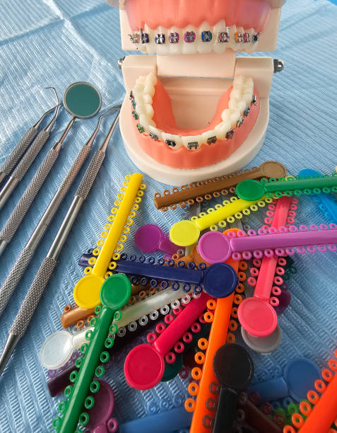 Braces model with colorful elastics and dental tools on a blue cloth in a clinical setting