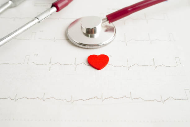Stethoscope on electrocardiogram (ECG), heart wave, heart attack, cardiogram report.