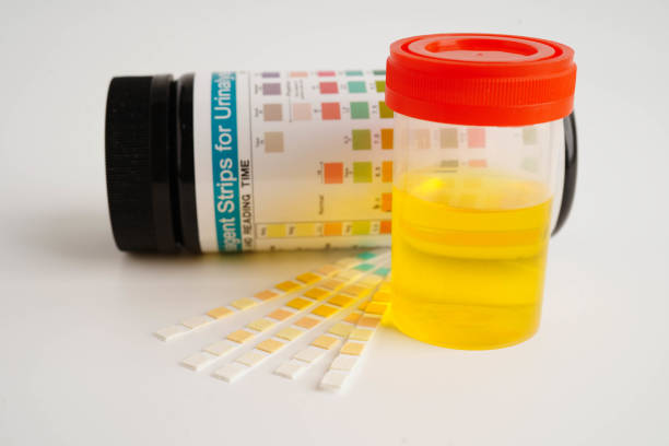 istock Urinalysis, urine cup with reagent strip pH paper test and comparison chart in laboratory. 2183709612