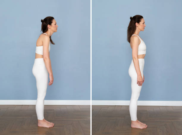 istock Posture problems, spinal curvature, scoliosis and correct posture 2183945180